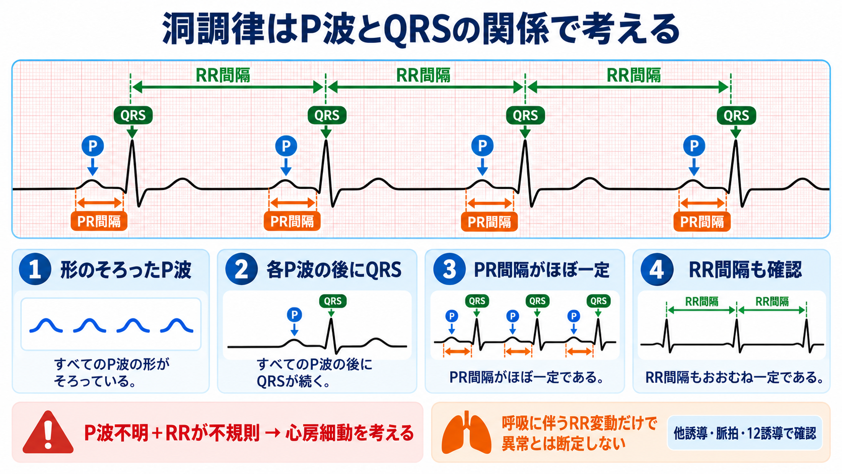 心電図の読み方を基礎から整理｜新人看護師・看護学生のための判読手順と緊急波形：規則性とP波を見て、洞結節から始まるリズムかを考えるの図解