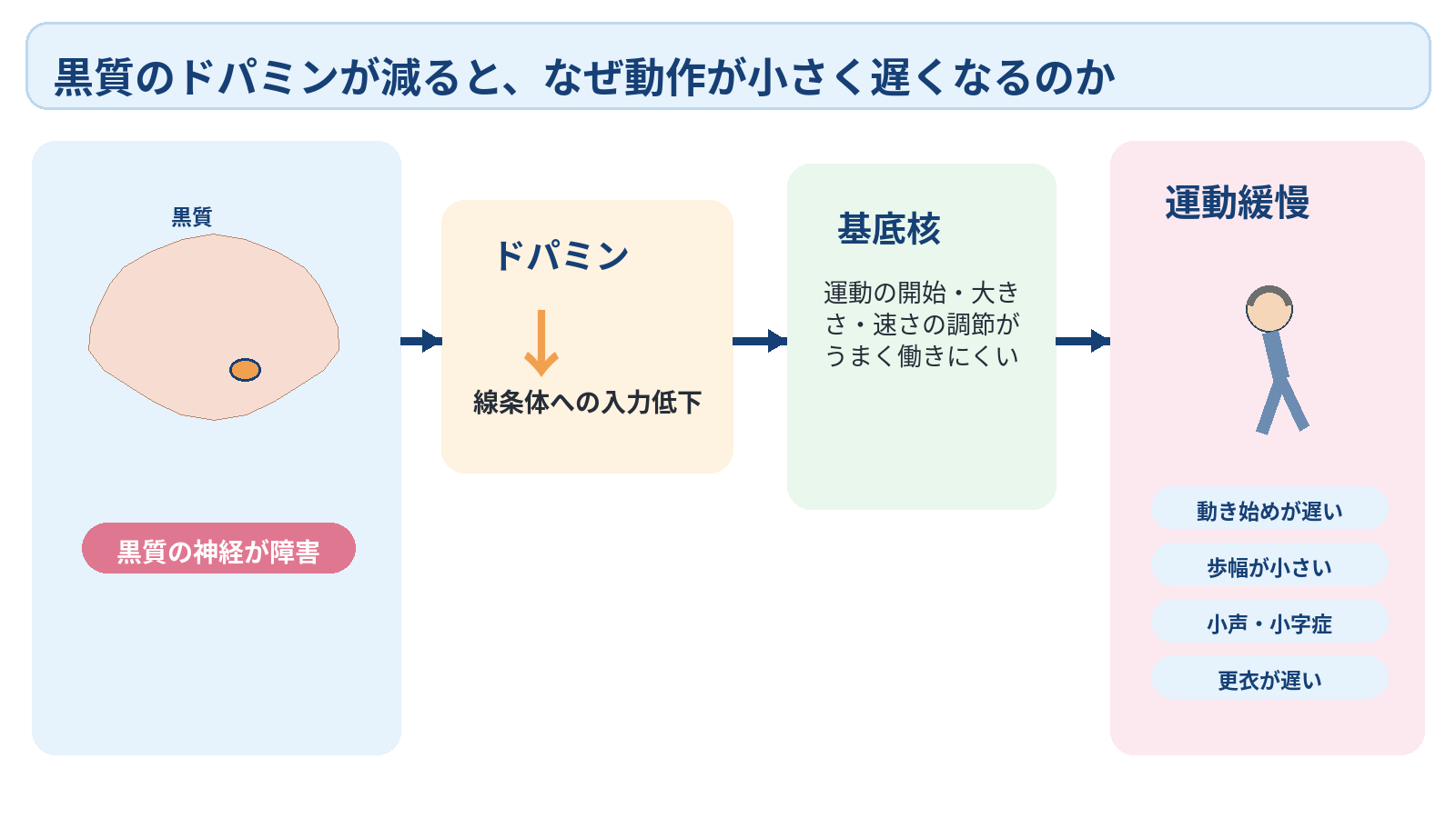 パーキンソン病を病態から看護観察まで理解する｜症状・診断・薬効変動の見かた：黒質のドパミンが減ると、なぜ動作が小さく遅くなるのかの図解