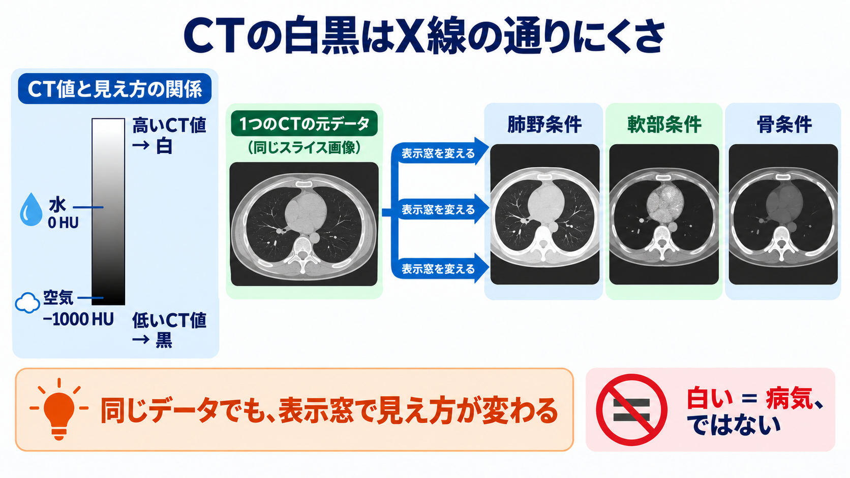 なぜ体の中が見える？CTとMRIを物理から理解する――画像の白黒と看護観察の意味：CTの白黒は「X線の通りにくさ」であり、表示窓でも見え方が変わるの図解