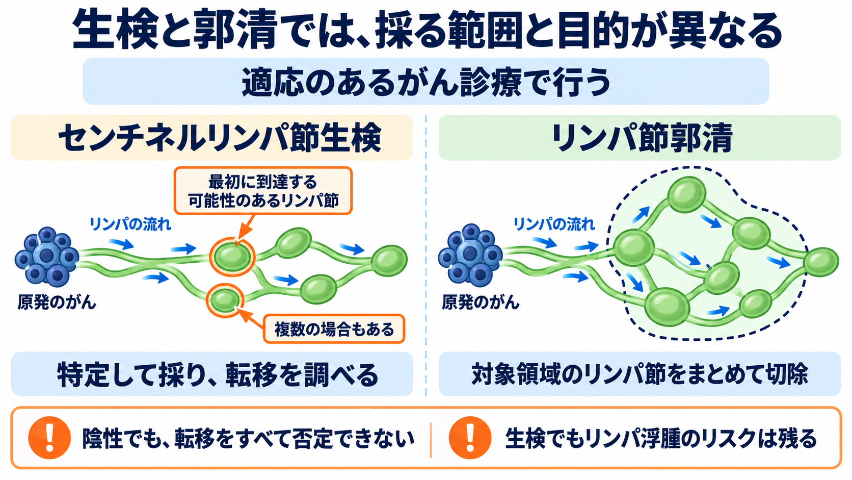 リンパ節の働きと腫れの見方を、看護の観察につなげる：センチネルリンパ節生検と郭清は、がんの広がりを評価・治療するために行うの図解