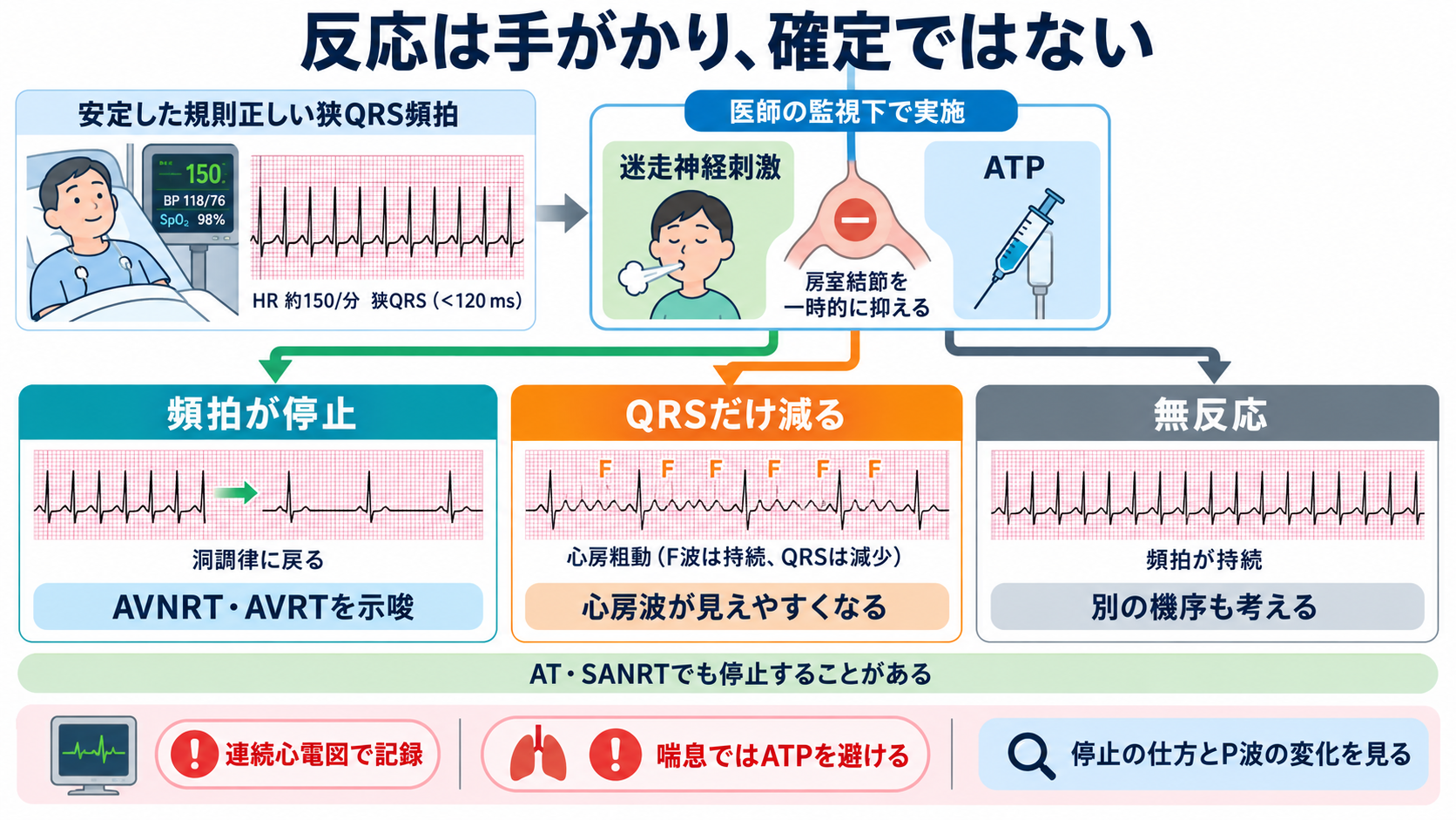 頻脈の見分け方：洞性頻脈・PSVT・AVNRT・AVRT・SANRT・AT・2:1心房粗動を順番に理解する：迷走神経刺激やATPへの反応は有用だが、AVNRT・AVRTの確定検査ではないの図解