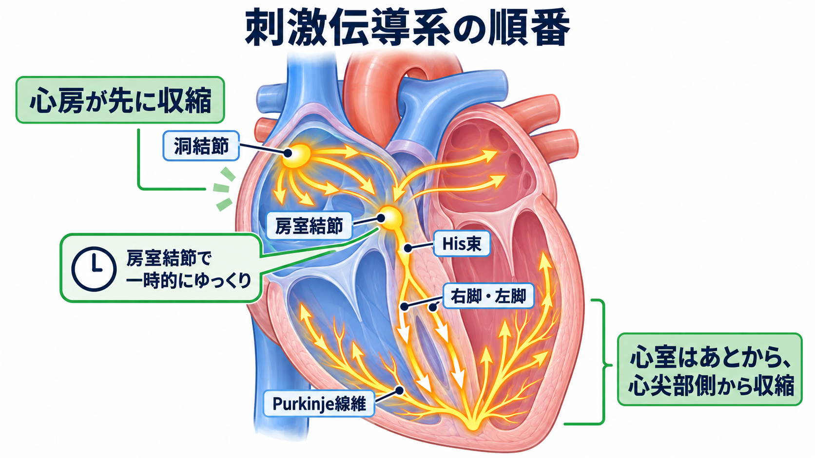 心臓の解剖を血流から理解する｜4つの部屋・弁・冠動脈・刺激伝導系と看護観察：刺激伝導系は、心房を先に、心室を後に収縮させる電気の経路であるの図解