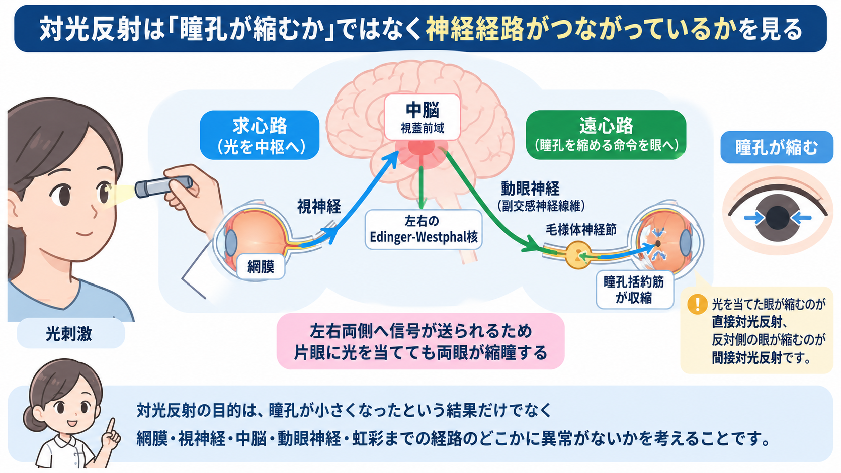 対光反射の見かた｜散瞳・縮瞳・瞳孔不同を症状別に理解する：対光反射を見る前に、まず瞳孔径・左右差・形を確認するの図解
