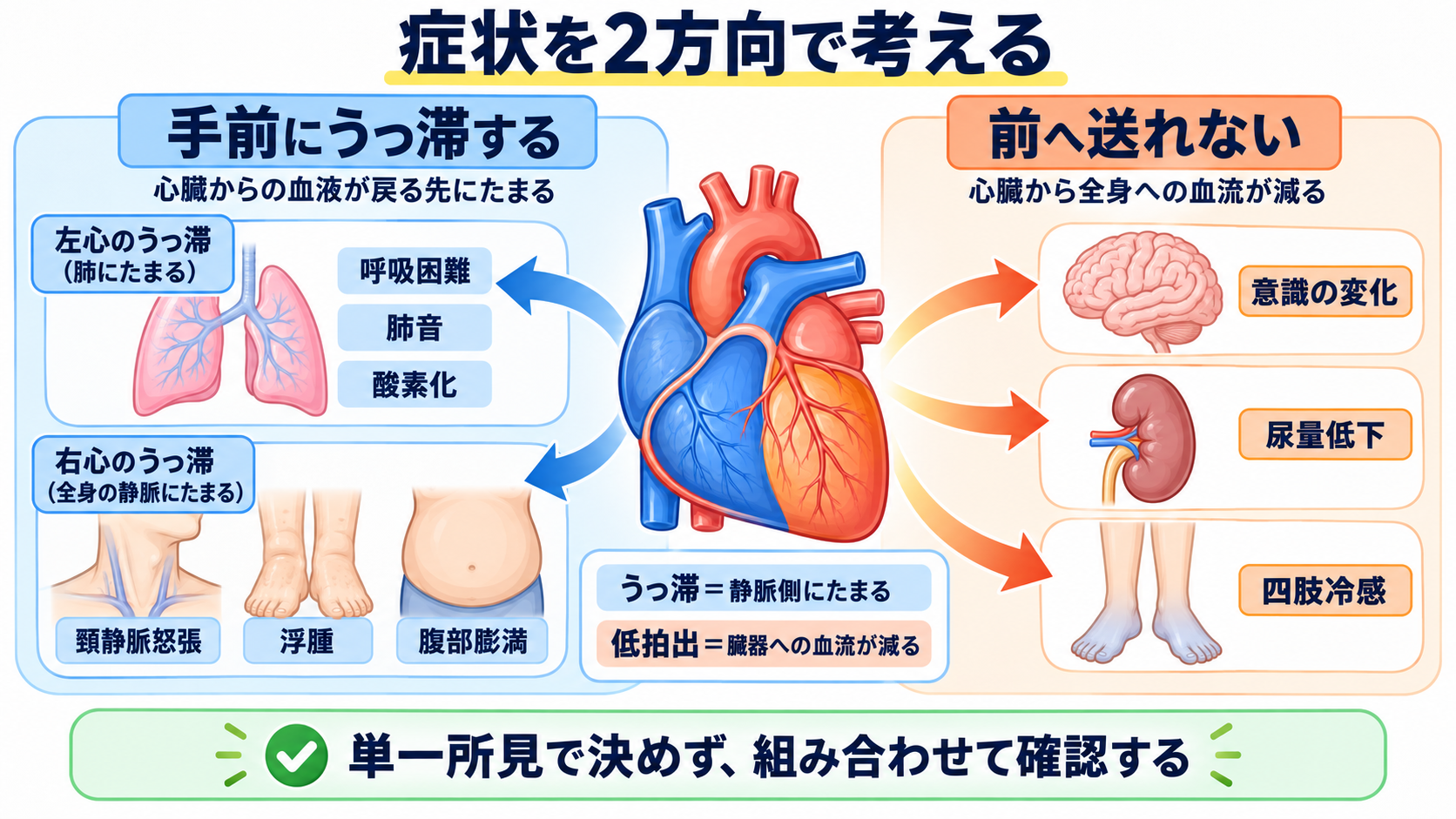 心臓の解剖を血流から理解する｜4つの部屋・弁・冠動脈・刺激伝導系と看護観察：症状は「前へ送れない」と「手前にうっ滞する」の2方向で考えるの図解