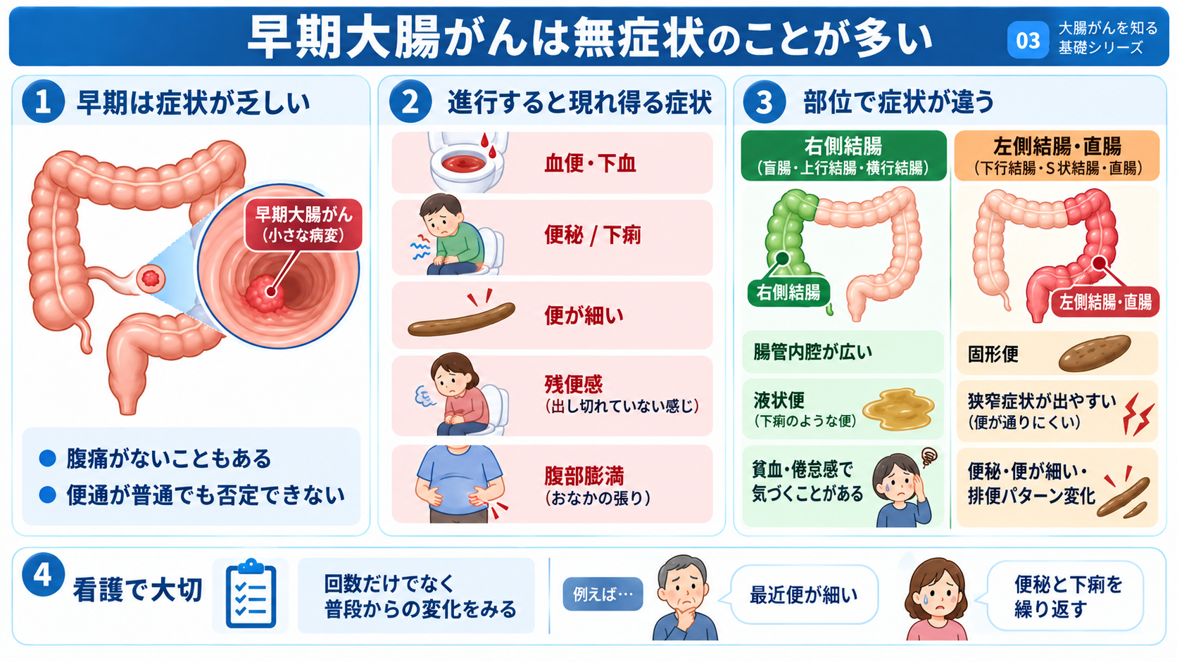 大腸がんとは？症状・検査・治療から術後の看護観察まで分かりやすく解説：早期大腸がんは症状がないことが多く、症状がないことでは否定できないの図解