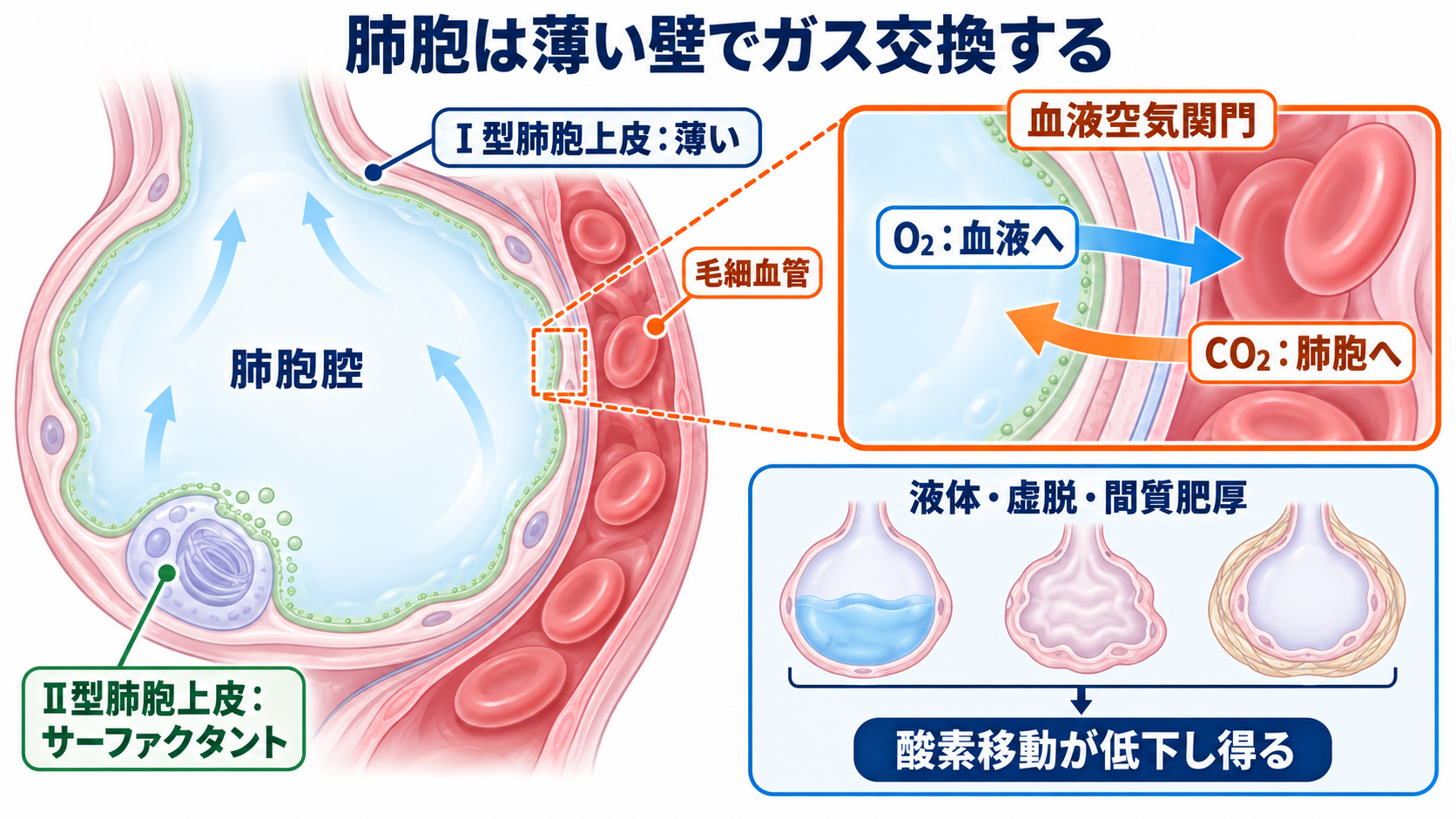 肺の解剖を臨床につなげる：肺葉・肺区域・肺胞・胸膜と看護観察：肺胞は薄い壁と毛細血管を密着させたガス交換面であるの図解