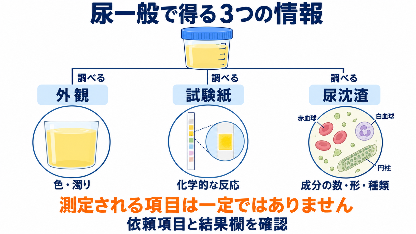 尿一般の項目一覧から、結果の読み方と看護での確認点を学ぶ：尿一般には、外観・試験紙・尿沈渣の確認があるの図解