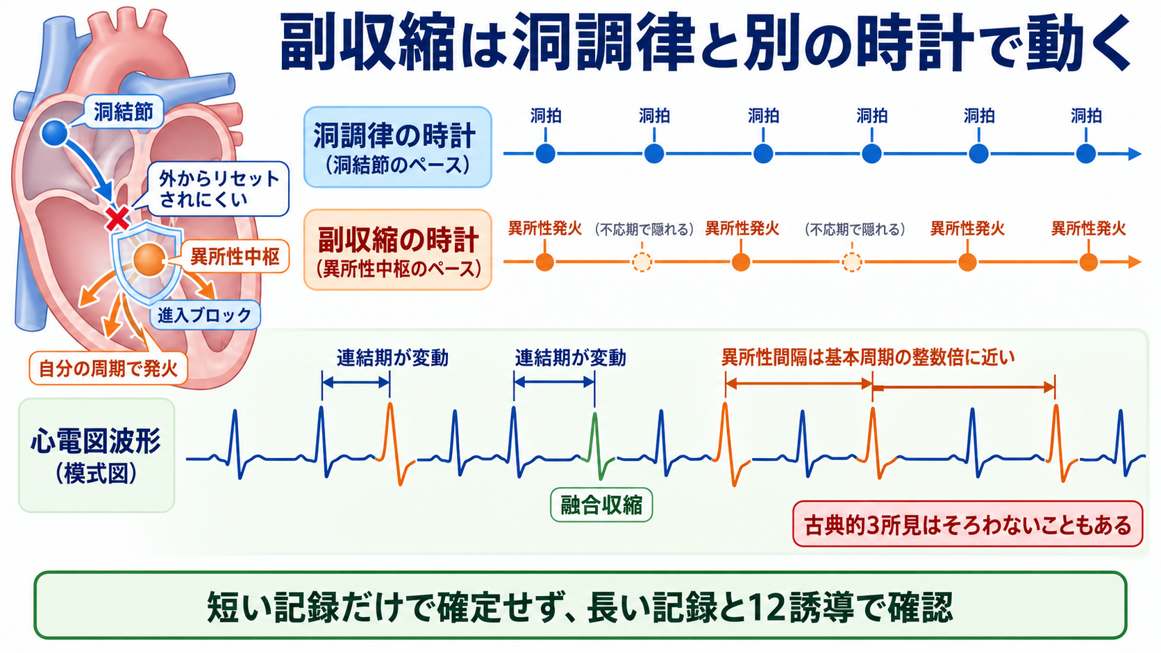 予定よりP波・QRS波が早いときの読み方――PVC、間入性・代償性休止期、副収縮、SVPCの見分け方と分類：副収縮は、洞結節とは別の「守られた発振源」が自分の周期で動くの図解