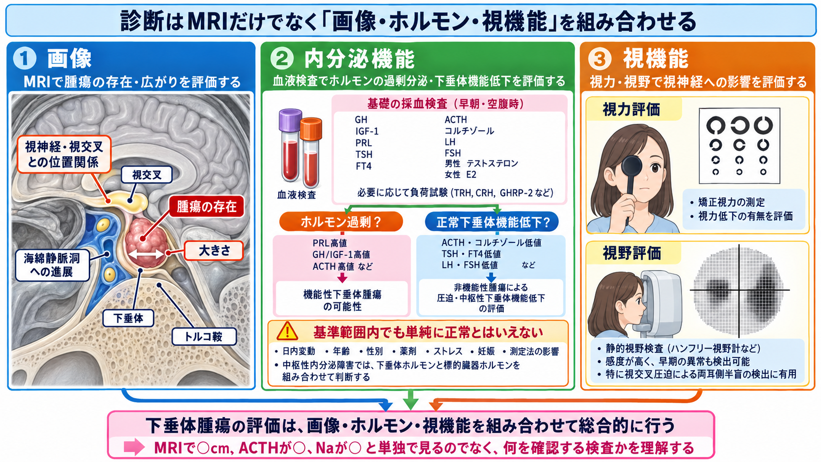 脳下垂体腫瘍とは？症状・ホルモン異常・治療と術後看護の観察ポイント：診断はMRIだけでなく「画像・ホルモン・視機能」を組み合わせるの図解