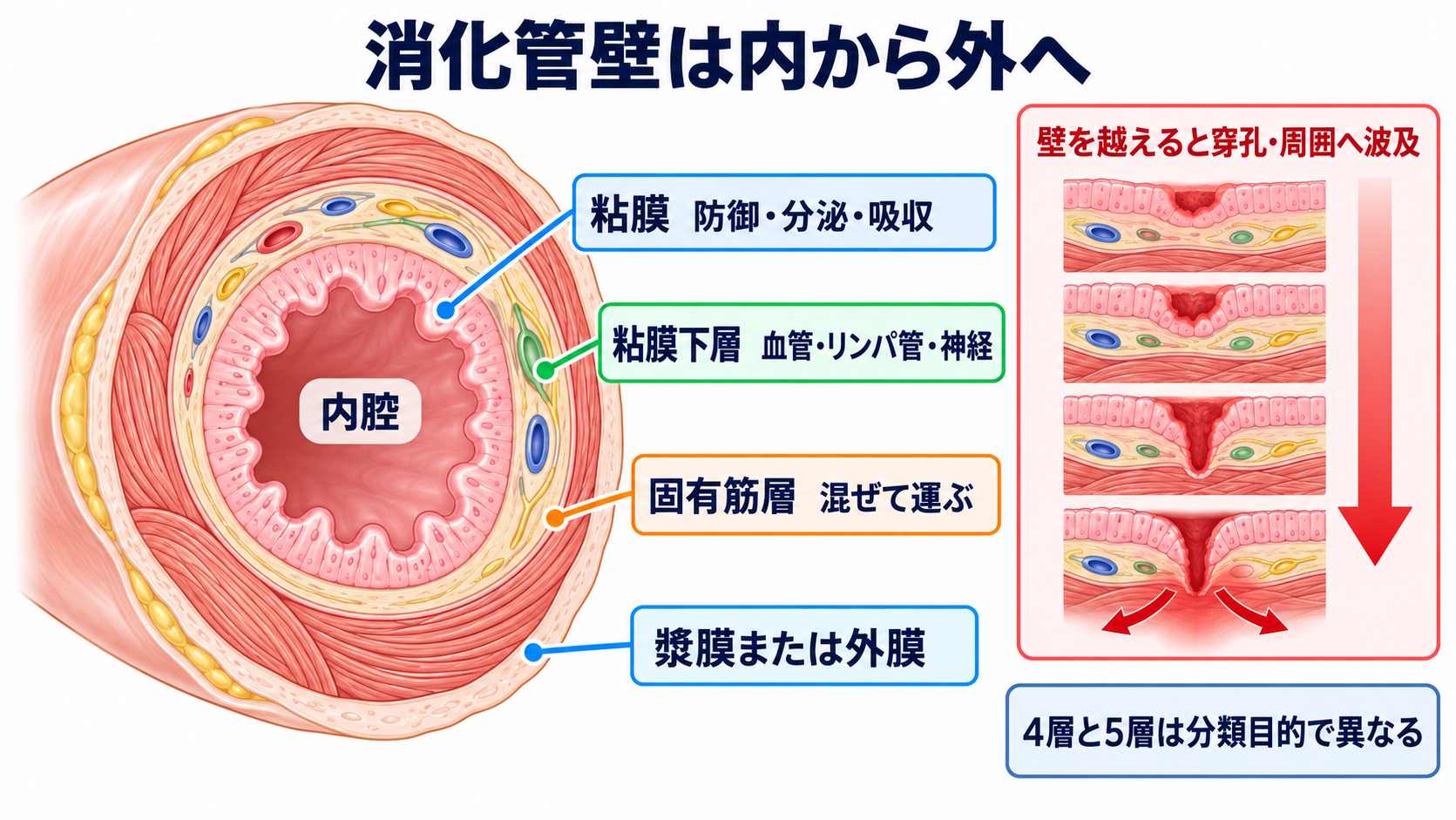 消化器の解剖を流れで理解する｜臓器・腹膜・血流と看護観察の意味：消化管壁の層を知ると、炎症・出血・穿孔・手術の意味が分かるの図解