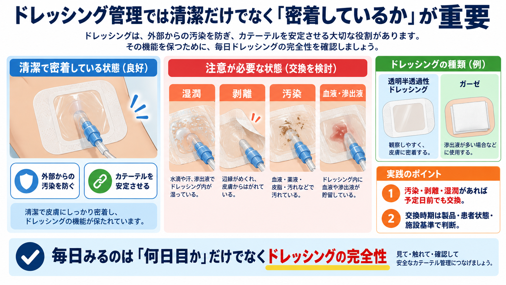 CVカテーテルとは？目的・種類から管理、観察項目、感染・閉塞・空気塞栓まで解説：ドレッシング管理では清潔だけでなく「密着しているか」が重要の図解