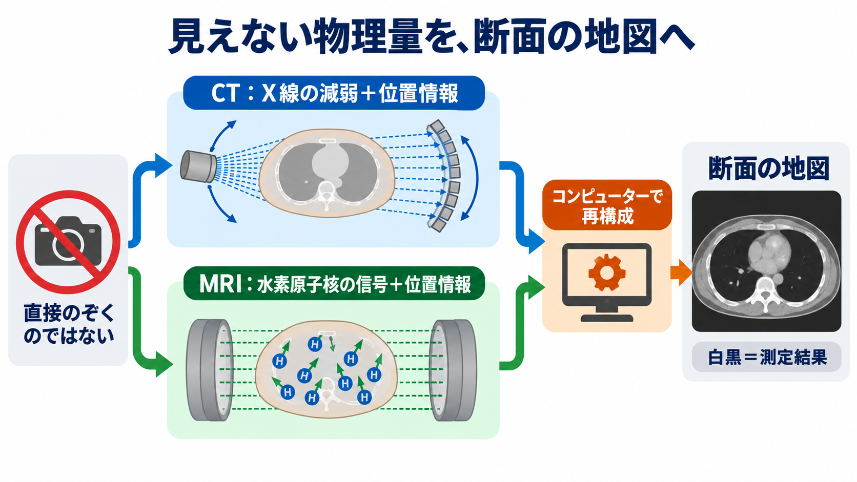 なぜ体の中が見える？CTとMRIを物理から理解する――画像の白黒と看護観察の意味：「透視」ではなく、見えない物理量を位置ごとに地図へ変えているの図解