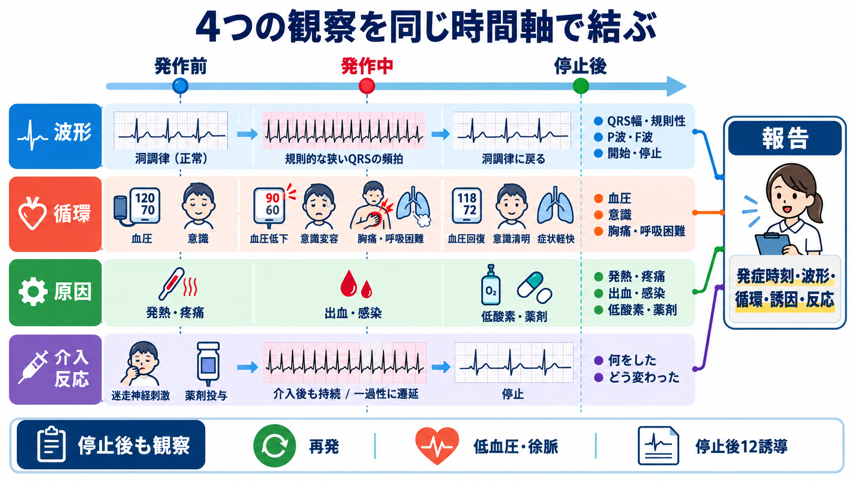 頻脈の見分け方：洞性頻脈・PSVT・AVNRT・AVRT・SANRT・AT・2:1心房粗動を順番に理解する：看護観察は「波形」「循環」「原因」「介入反応」を同じ時間軸で結び付けるの図解