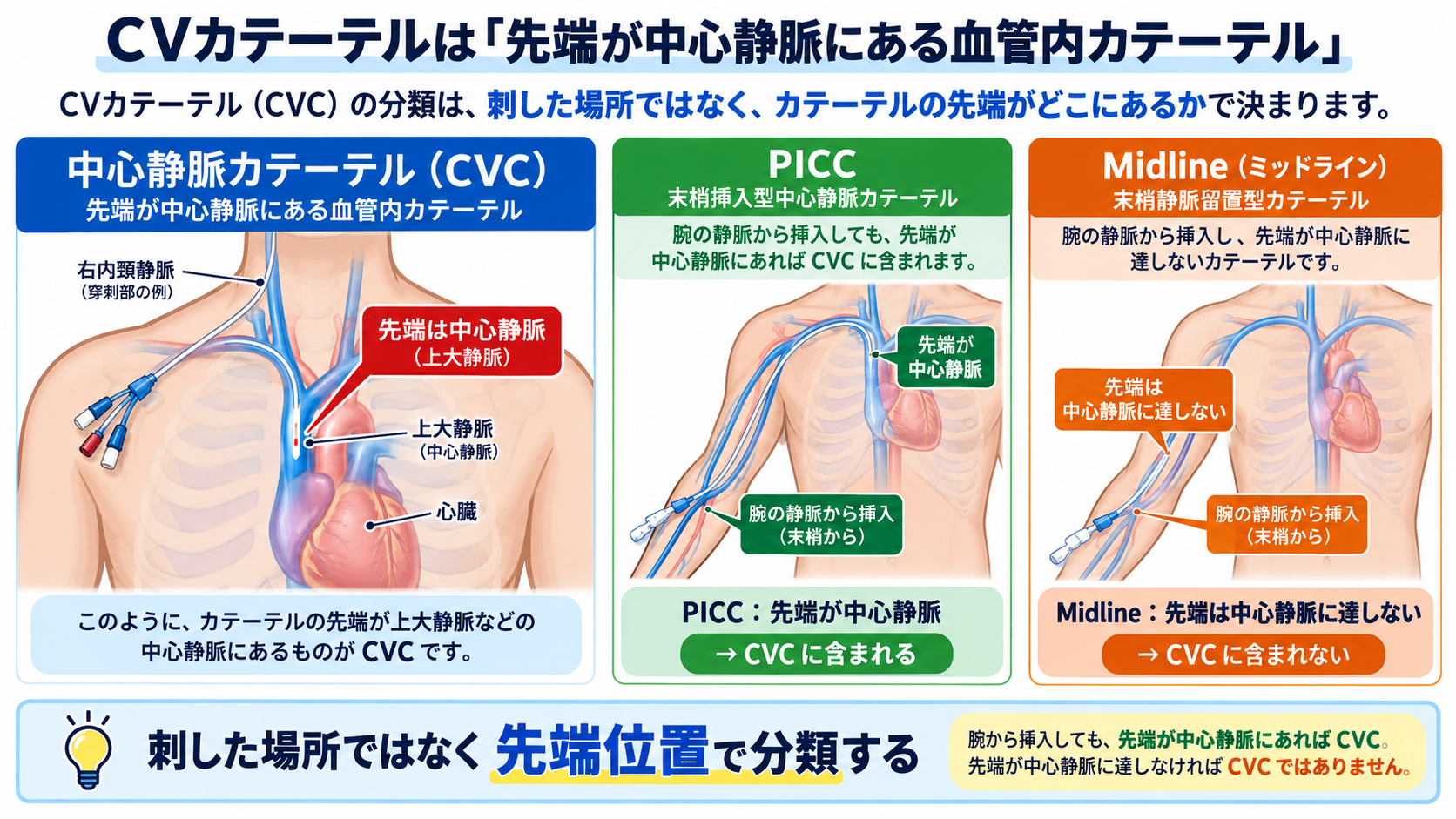 CVカテーテルとは？目的・種類から管理、観察項目、感染・閉塞・空気塞栓まで解説：CVカテーテルは「先端が中心静脈にある血管内カテーテル」の図解