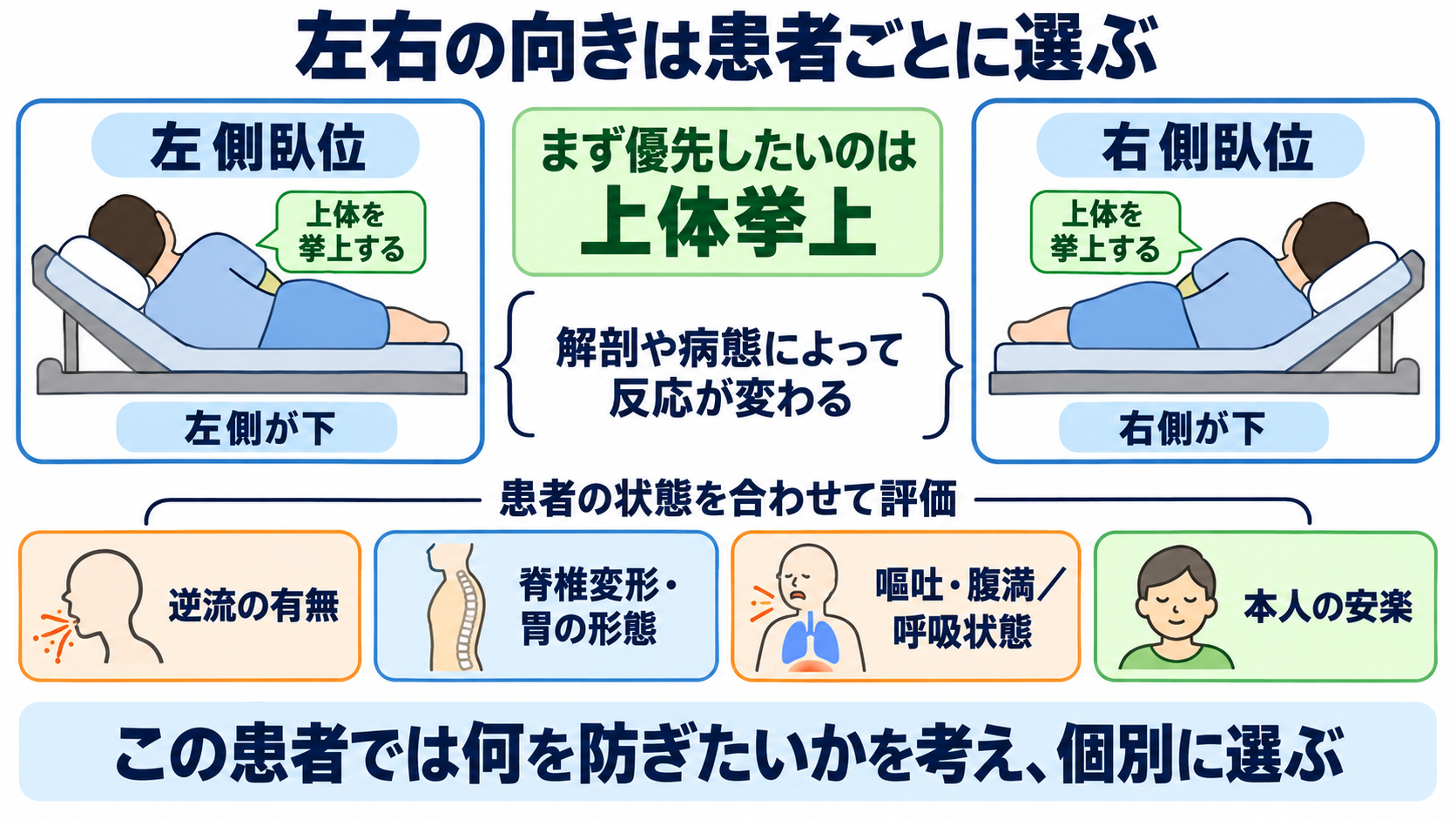 経鼻経管栄養の使い方｜体位の基本とチューブ位置確認、誤嚥・閉塞を防ぐ注意点：左側臥位と右側臥位は、どちらか一方を全患者の正解にはできないの図解