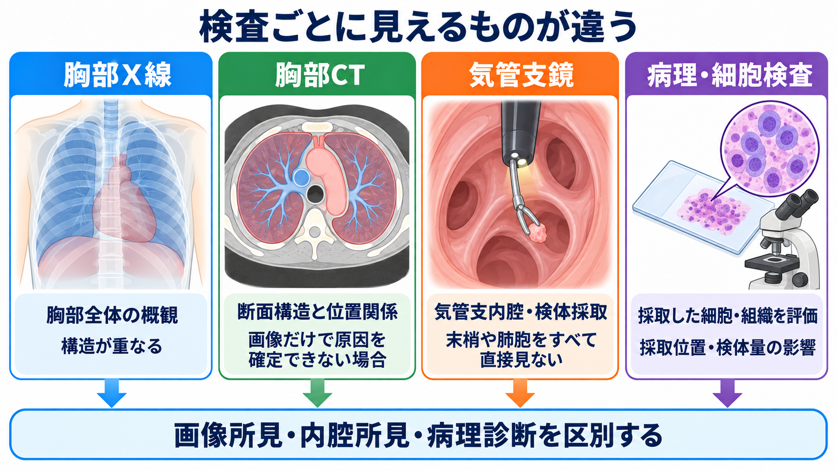 肺の解剖を臨床につなげる：肺葉・肺区域・肺胞・胸膜と看護観察：胸部X線、CT、気管支鏡は同じものを見ているわけではないの図解