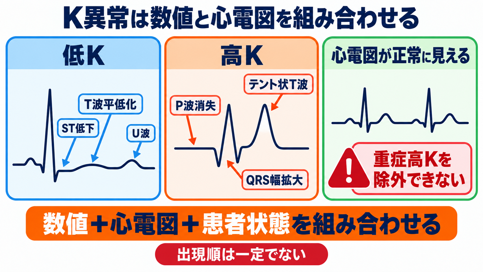 Na・K異常の読み方｜症状・心電図・採血エラーをつないで緊急度を判断する：心電図はK異常の危険度を示すが、正常でも除外には使えないの図解