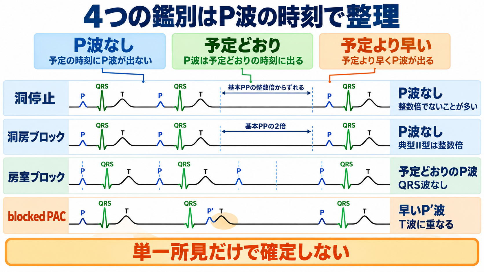 心電図でP波・QRS波が予定位置にないときの見分け方―洞停止、洞房ブロック、房室ブロック、ブロックSVPC：4つの鑑別は「P波の有無」ではなく「P波がいつ出たか」で整理するの図解