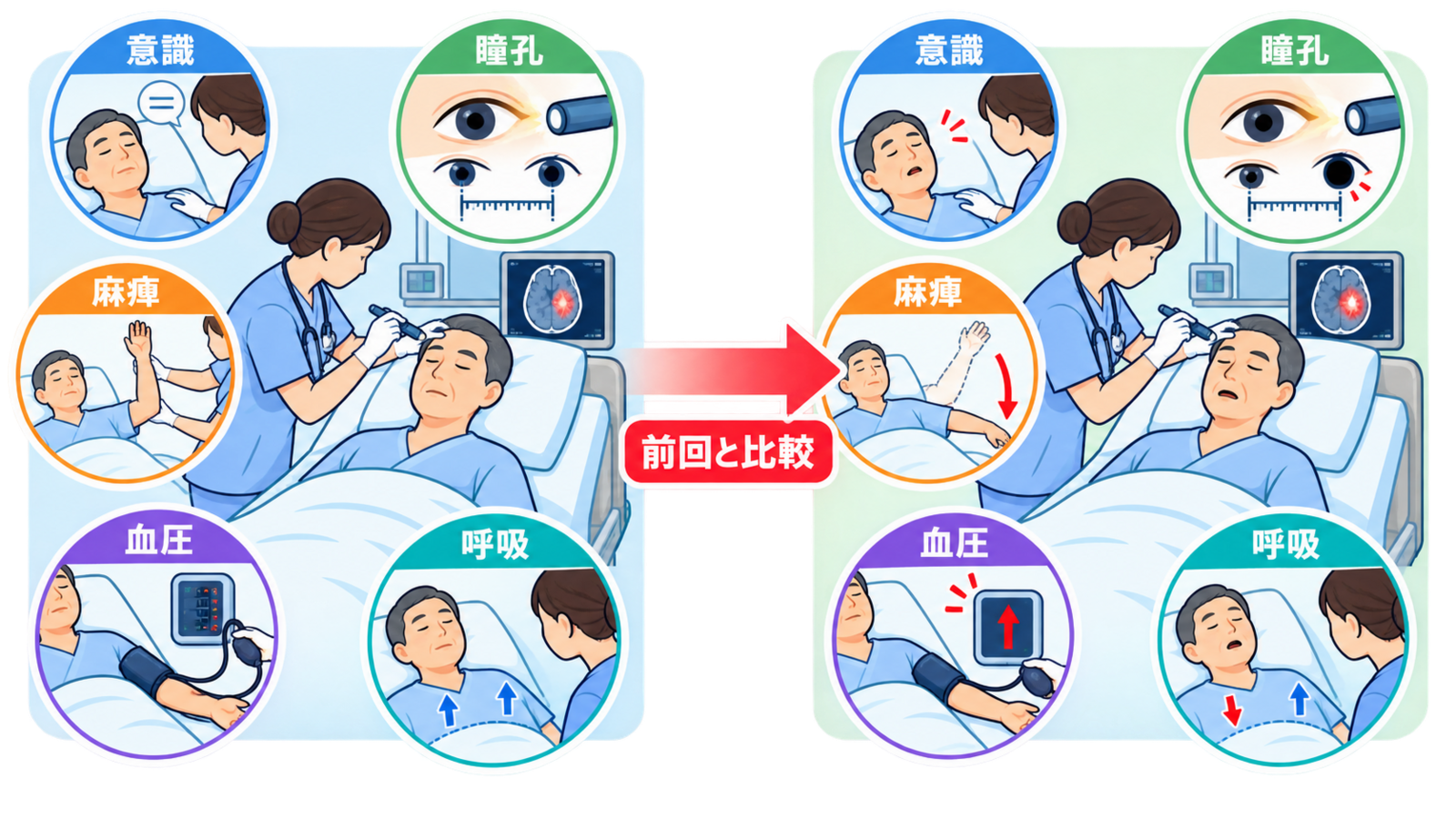 脳出血とは？部位別症状・急性期治療・看護の観察ポイントをわかりやすく解説：脳出血の手術は、部位・血腫量・意識・水頭症を合わせて判断するの図解