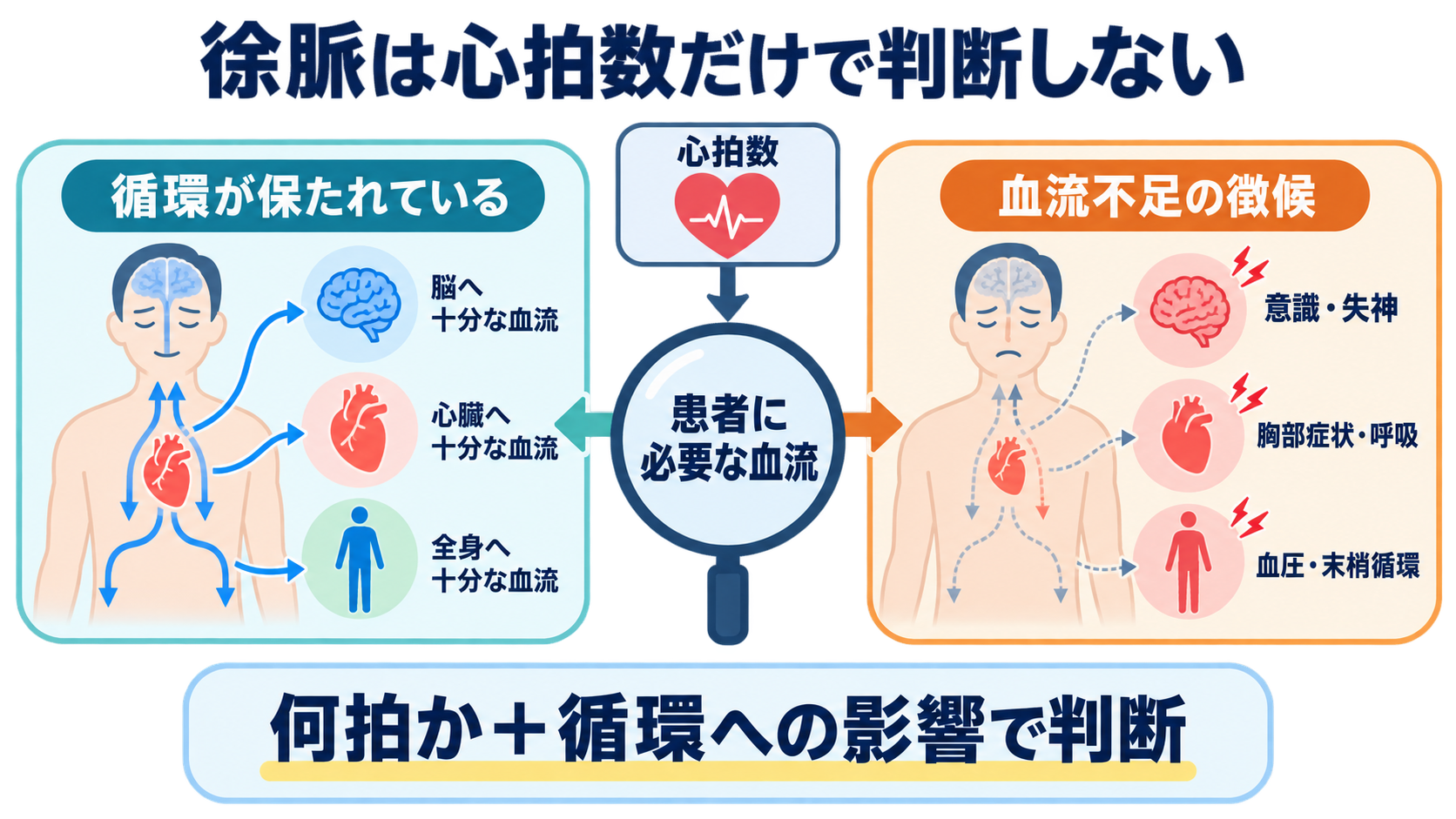 徐脈をどう見分ける？洞徐脈・SSS・徐脈頻脈症候群・房室ブロックの心電図と看護：徐脈は「何拍か」だけでなく、患者に必要な血流を保てているかで判断するの図解