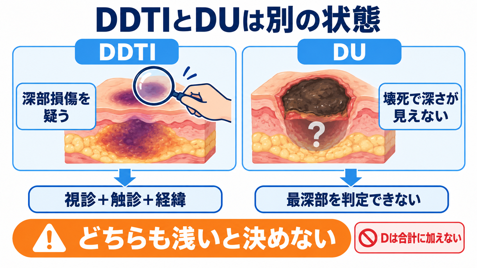 褥瘡の段階はどう伝える？DESIGN-R®2020で皮膚状況を観察・報告する方法：深さは最深部で判定し、DDTIとDUを混同しないの図解