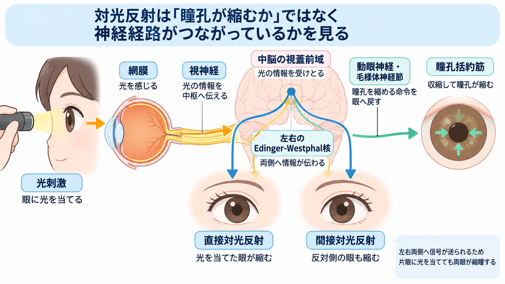 対光反射の見かた｜散瞳・縮瞳・瞳孔不同を症状別に理解する：両側散瞳・対光反射消失は重い所見だが、それだけで原因や予後を決めないの図解