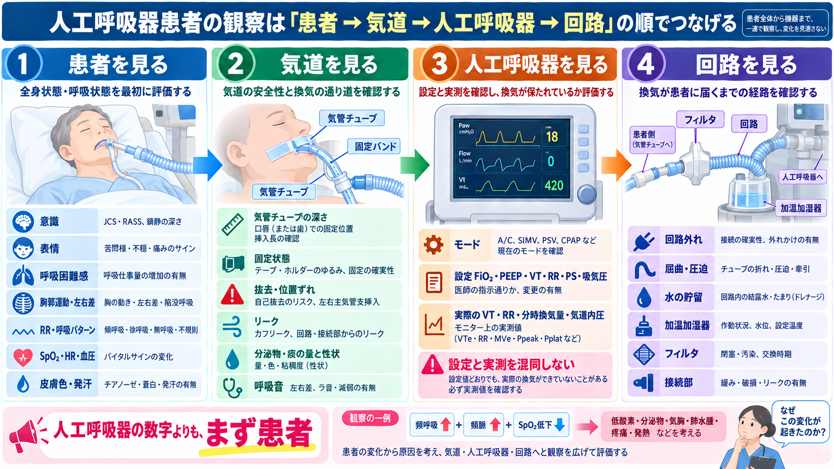 人工呼吸器のモードを理解する｜A/C・SIMV・PSV・CPAPの使い分け、設定、観察項目とアラーム対応：人工呼吸器患者の観察は「患者→気道→人工呼吸器→回路」の順でつなげるの図解