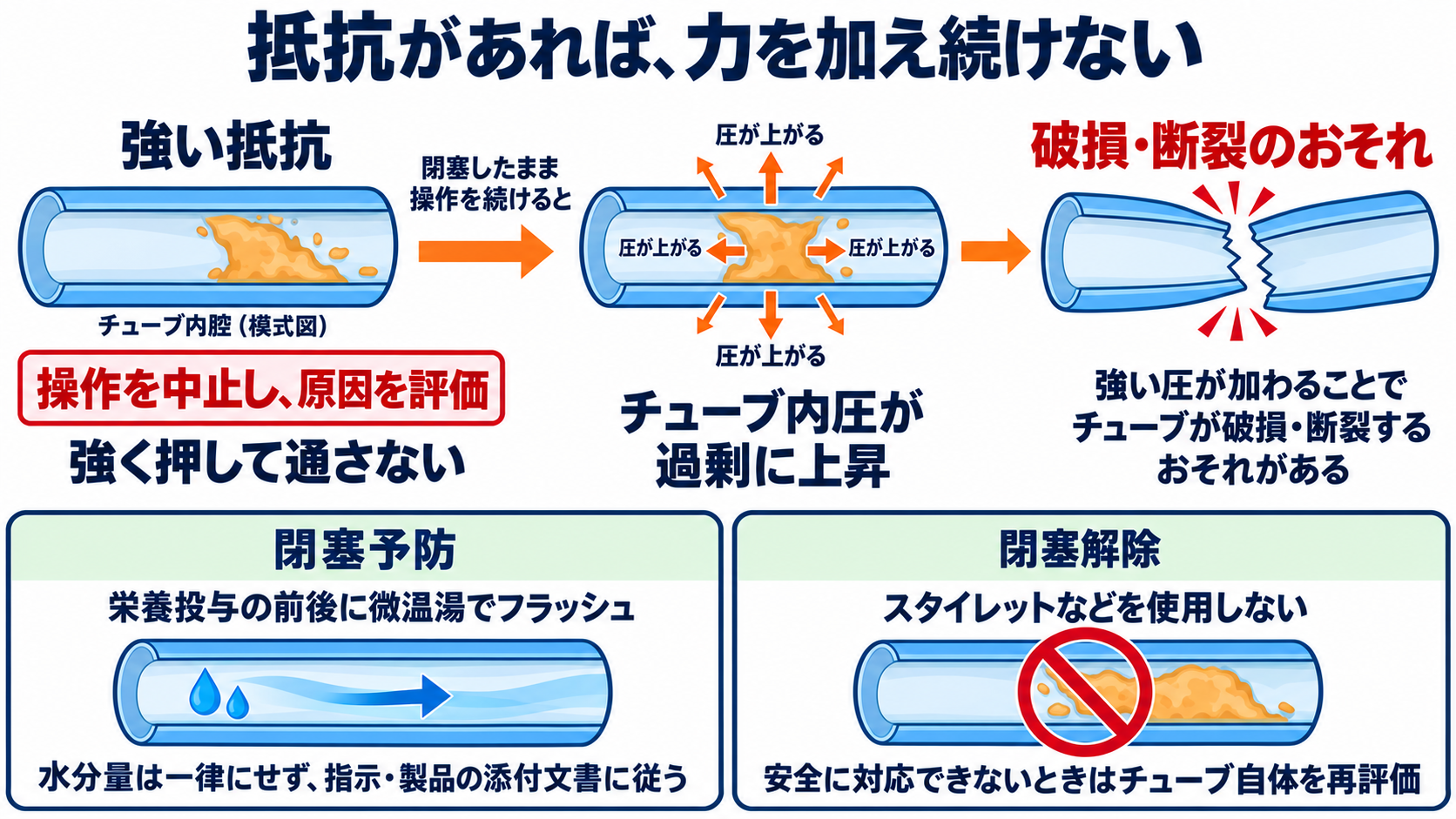 経鼻経管栄養の使い方｜体位の基本とチューブ位置確認、誤嚥・閉塞を防ぐ注意点：チューブが通りにくいときは、強く押して「通す」のではなく閉塞を疑うの図解
