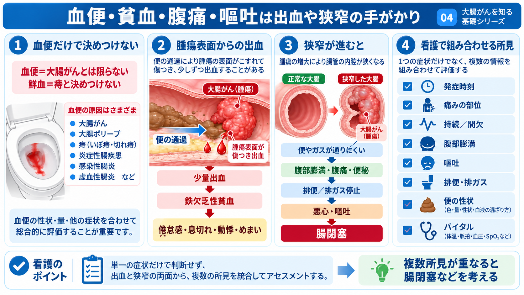 大腸がんとは？症状・検査・治療から術後の看護観察まで分かりやすく解説：血便・貧血・腹痛・嘔吐は、腫瘍による出血や狭窄を考える手がかりになるの図解