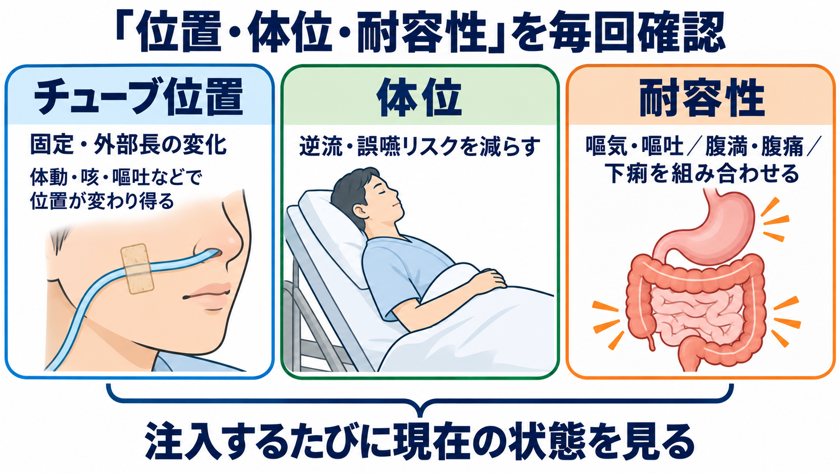 経鼻経管栄養の使い方｜体位の基本とチューブ位置確認、誤嚥・閉塞を防ぐ注意点：経鼻経管栄養で最初に押さえるのは「位置・体位・耐容性」の3つの図解