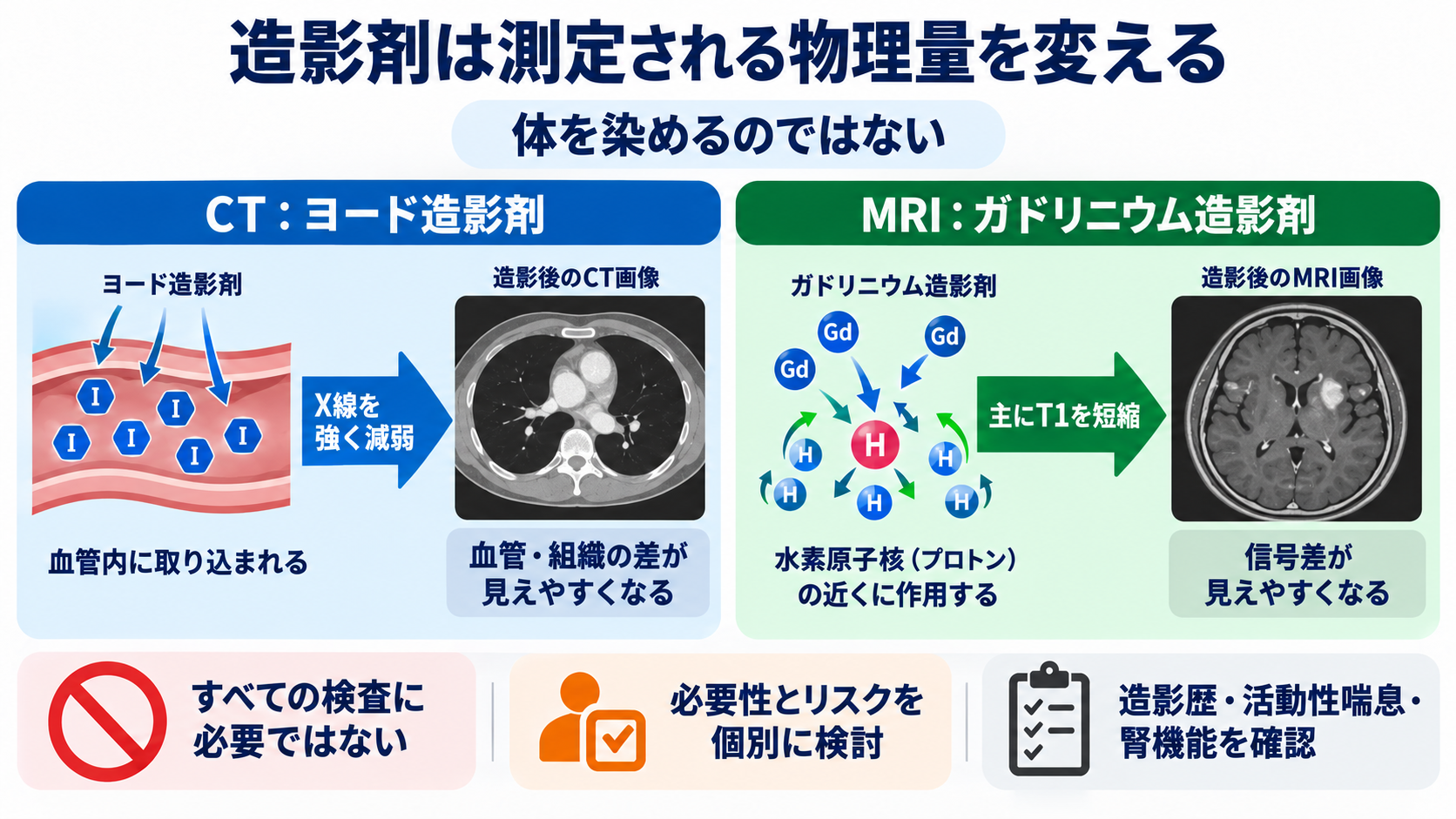 なぜ体の中が見える？CTとMRIを物理から理解する――画像の白黒と看護観察の意味：造影剤は「色を付ける」のではなく、測定される物理量を変えるの図解