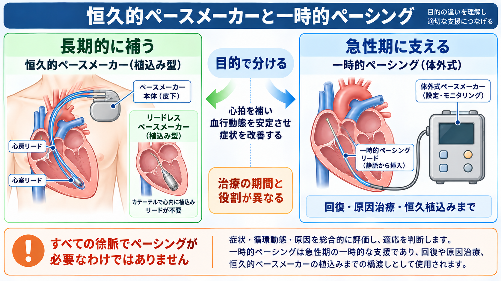 ペースメーカーの種類と適応を整理する｜VVI・DDD・リードレスから看護観察まで：ペースメーカーは大きく「恒久的」と「一時的」に分けて考えるの図解