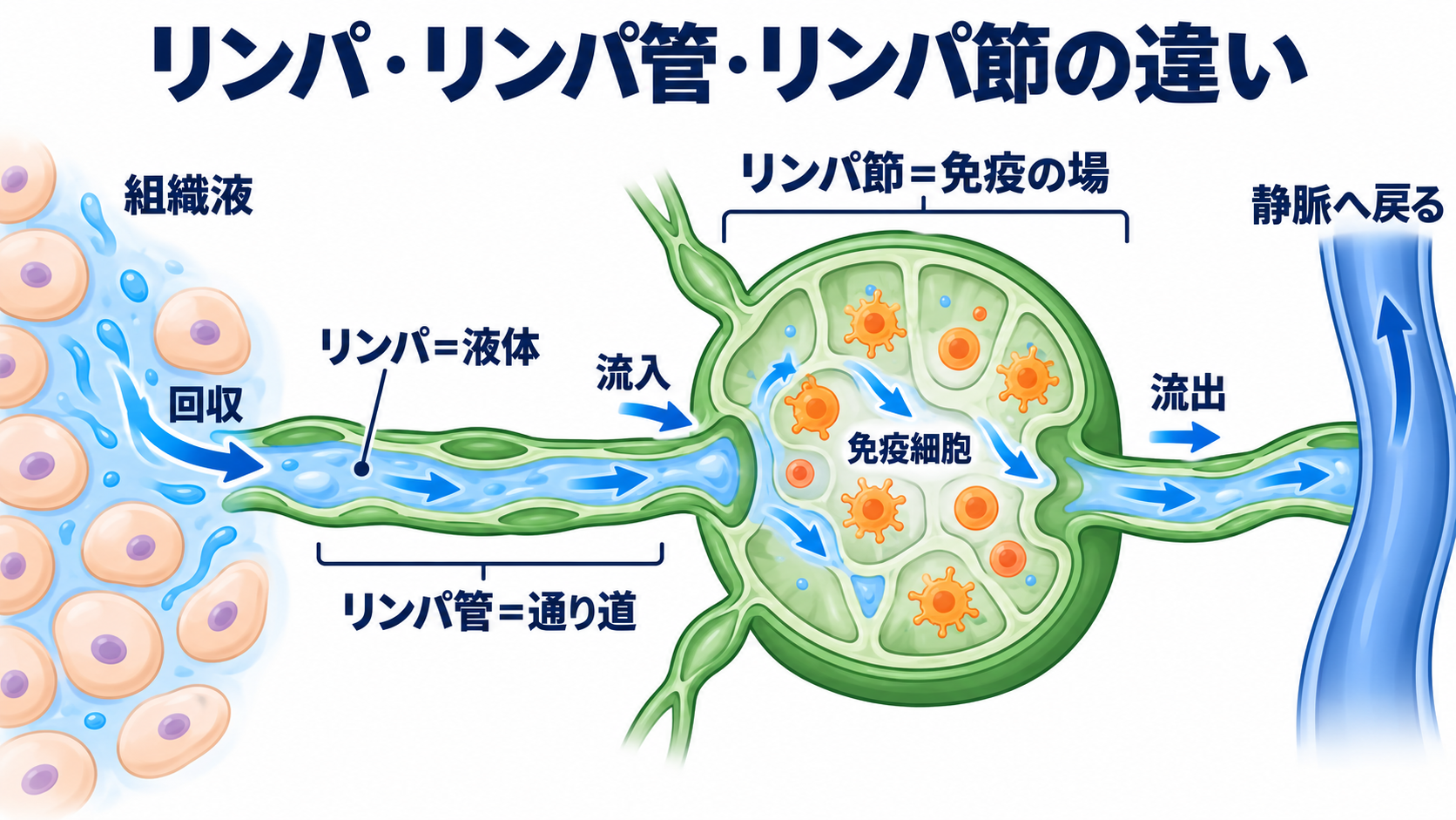 リンパ節の働きと腫れの見方を、看護の観察につなげる：リンパ・リンパ管・リンパ節は、液体・通り道・免疫の場の図解