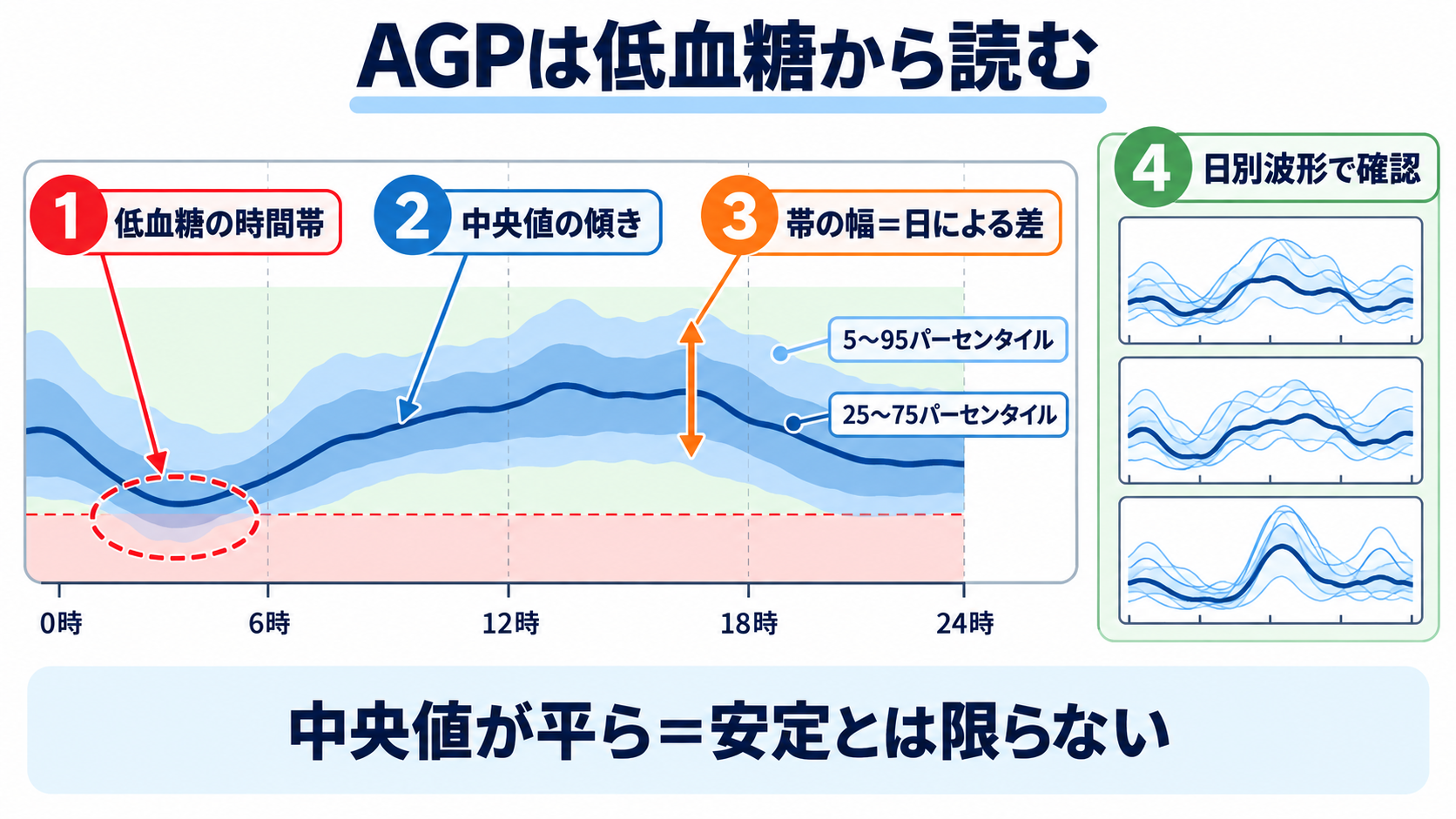 CGM・TIRの読み方｜血糖変動を看護アセスメントにつなげる手順：手順3：AGPでは低血糖の時間帯、帯の幅、中央値の順にパターンを探すの図解