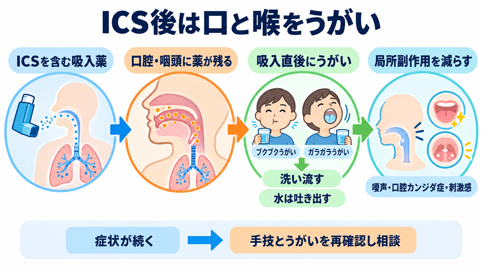 吸入薬の使い方が分かる｜薬の種類・デバイス・うがい・吸入指導の基本：吸入後のうがいはICSの局所副作用を減らすために行うの図解