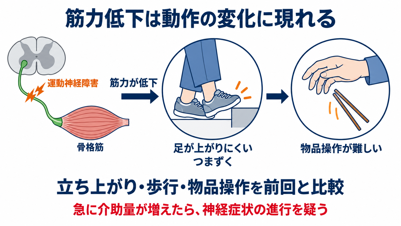 ニューロパチーとは？原因・症状・検査から看護観察と緊急性まで分かりやすく解説：運動神経障害では、筋力低下が転倒やADL低下として現れるの図解