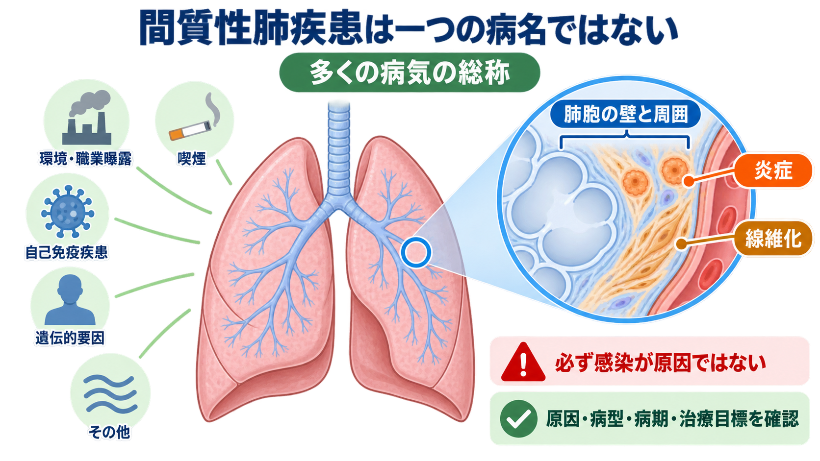 間質性肺疾患とは？病態・検査・治療から看護観察と急性増悪の見分け方まで：間質性肺疾患は「肺胞の壁を主な病変の場とする疾患群」であるの図解