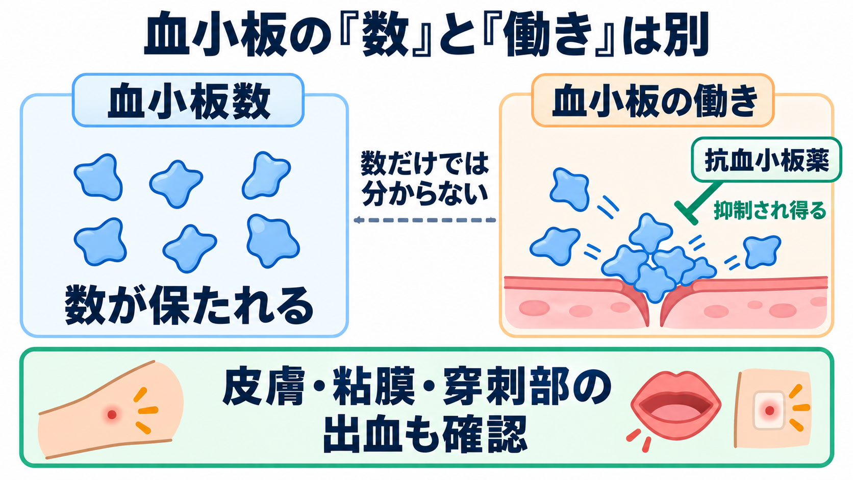 凝固・線溶検査の一覧と読み方――検査値を出血・血栓の観察につなげる：フィブリノゲンと血小板数は、減少の理由と機能を確認するの図解