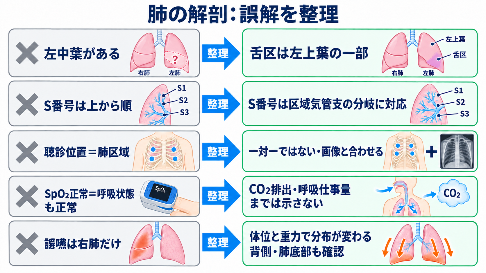 肺の解剖を臨床につなげる：肺葉・肺区域・肺胞・胸膜と看護観察：肺の解剖で誤解しやすいポイントを整理するの図解