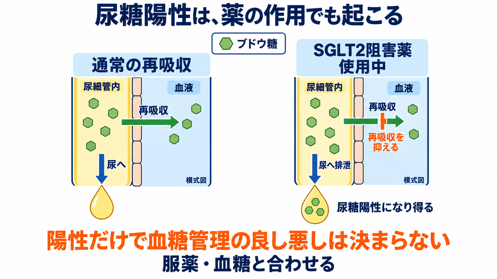 尿一般の項目一覧から、結果の読み方と看護での確認点を学ぶ：尿糖の陰性で糖尿病を除外せず、陽性は血糖と薬剤で読むの図解