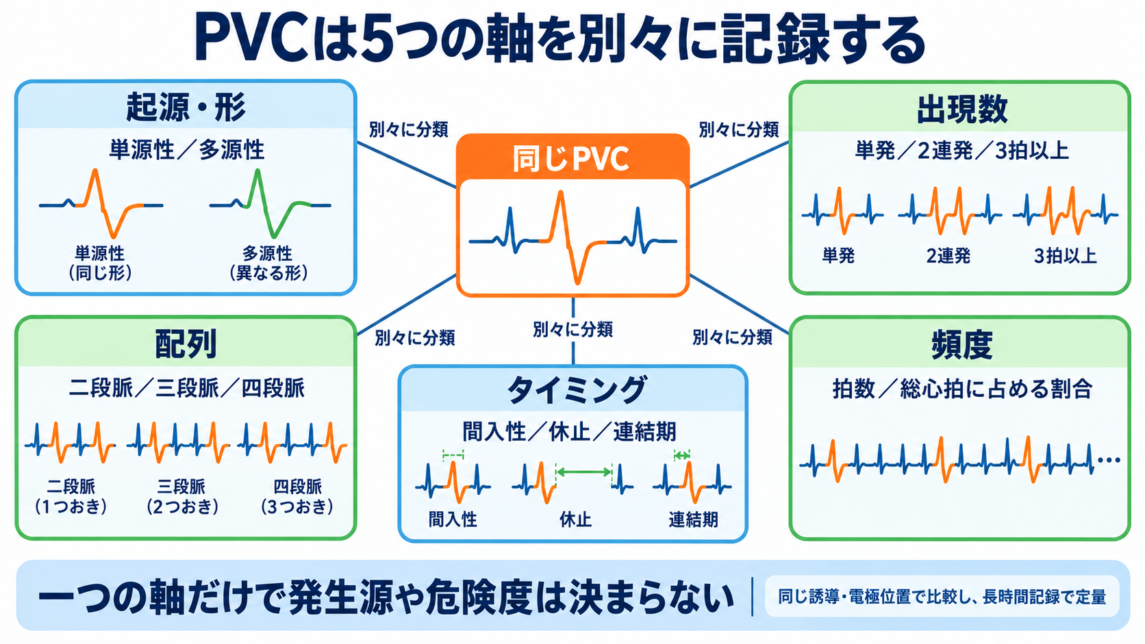 予定よりP波・QRS波が早いときの読み方――PVC、間入性・代償性休止期、副収縮、SVPCの見分け方と分類：PVCは「起源・出現数・配列・タイミング・頻度」を別々に分類するの図解