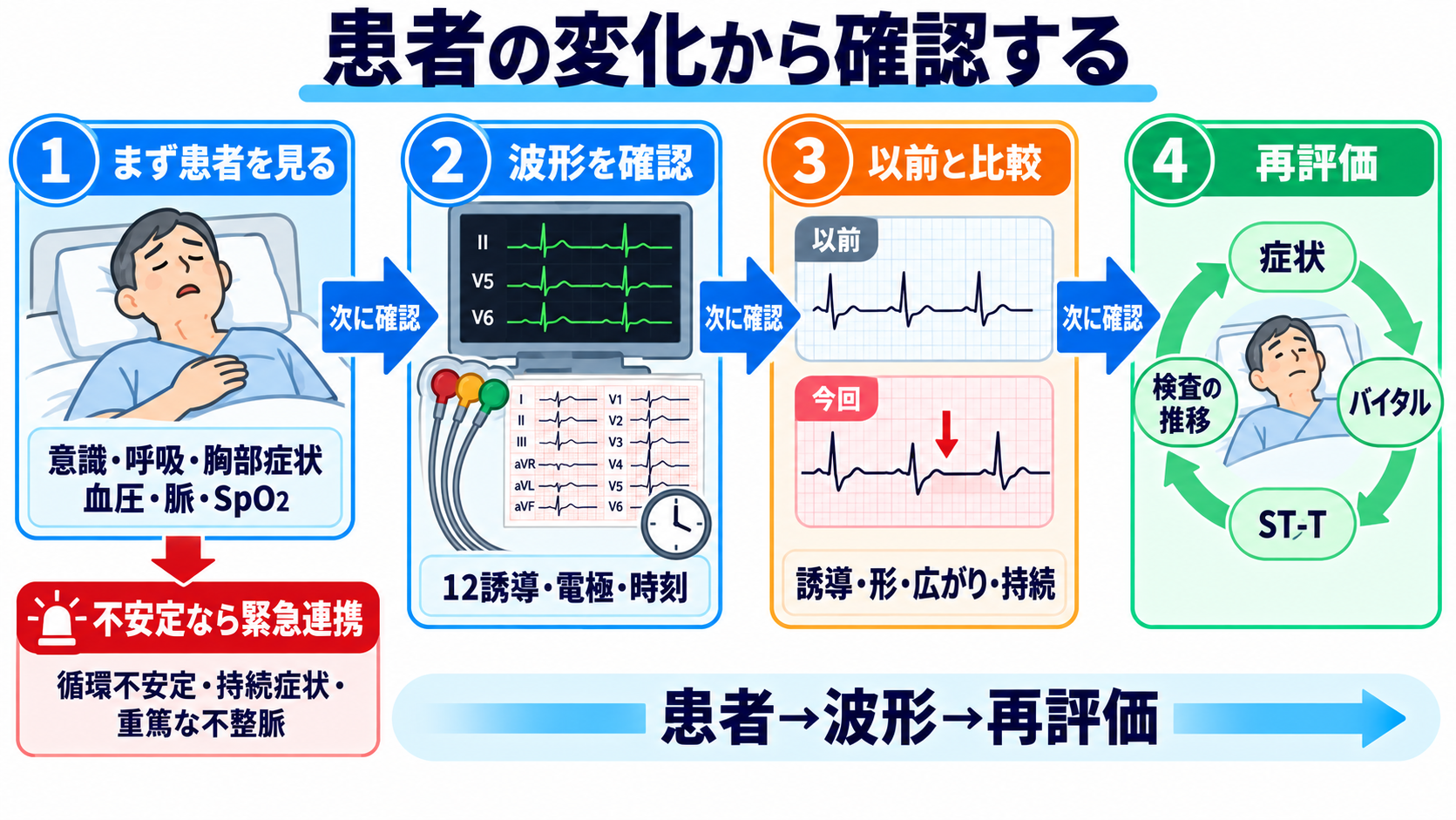 ST下降をどう読む？心筋虚血・心内膜下梗塞と二次性変化、薬剤・電解質異常の見分け方：看護では「患者の変化→波形の確認→再評価」の順で安全を確保するの図解