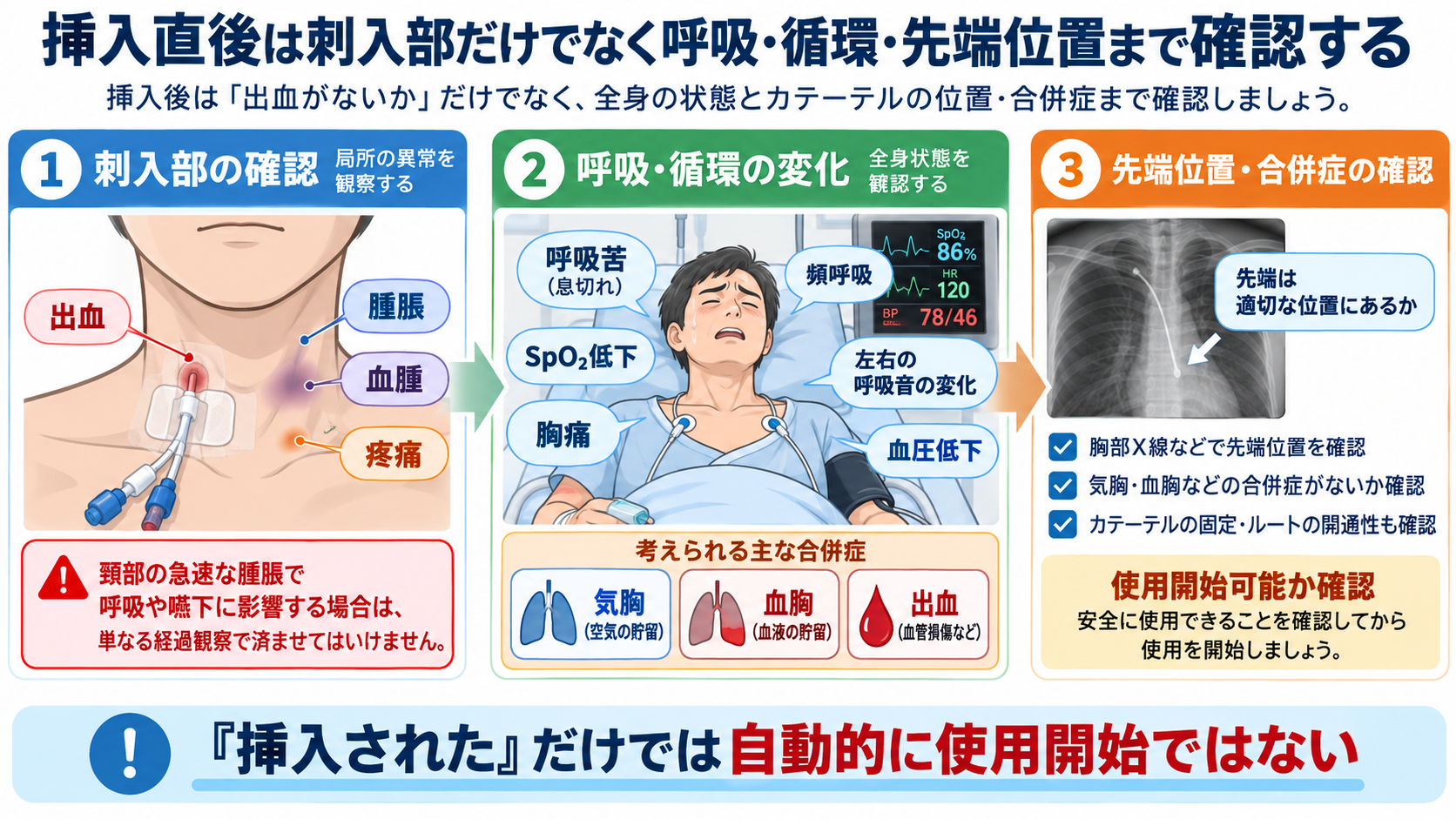 CVカテーテルとは？目的・種類から管理、観察項目、感染・閉塞・空気塞栓まで解説：挿入直後は刺入部だけでなく呼吸・循環・先端位置まで確認するの図解