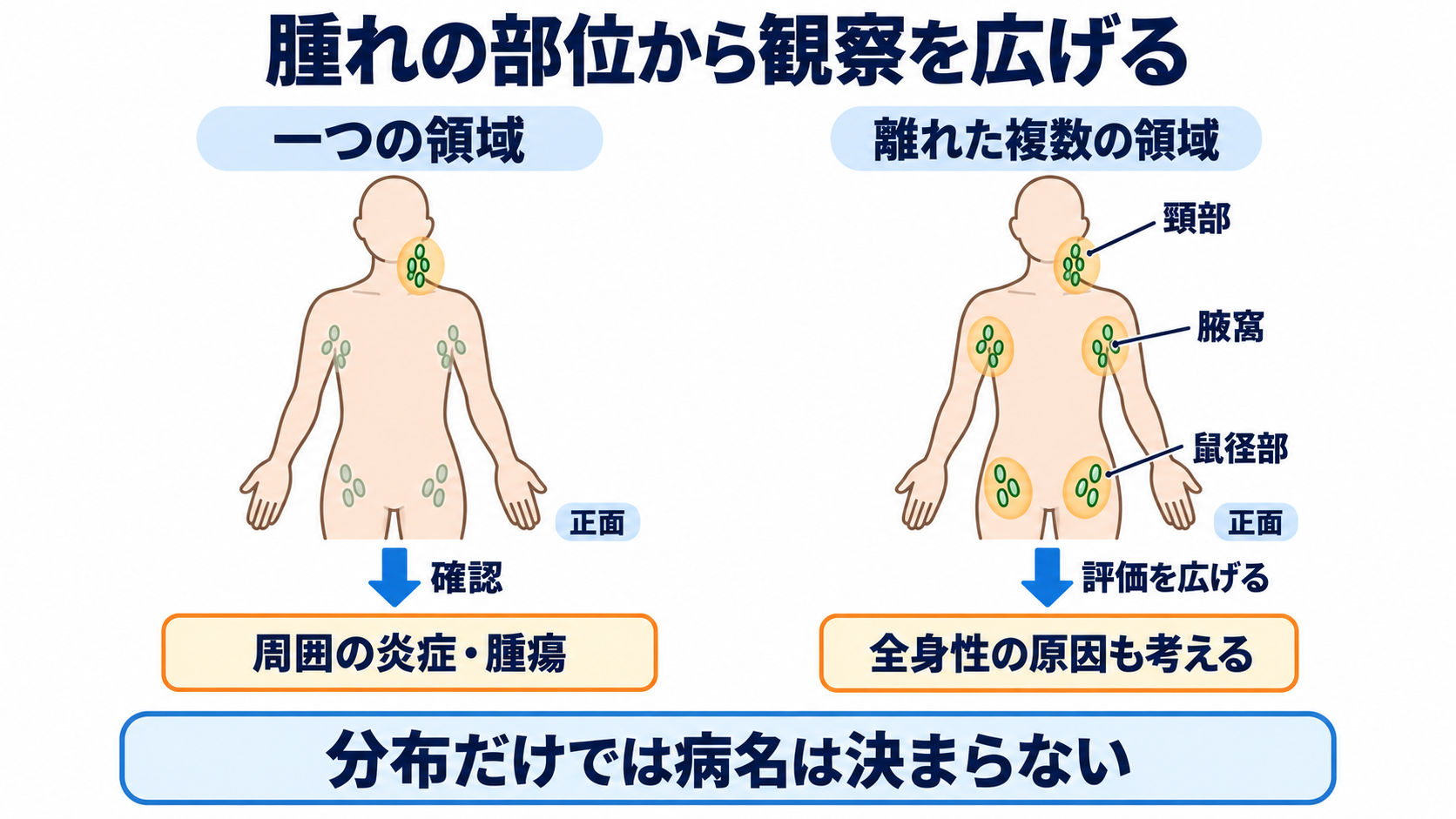 リンパ節の働きと腫れの見方を、看護の観察につなげる：腫れている部位と分布から、周囲と全身へ観察を広げるの図解
