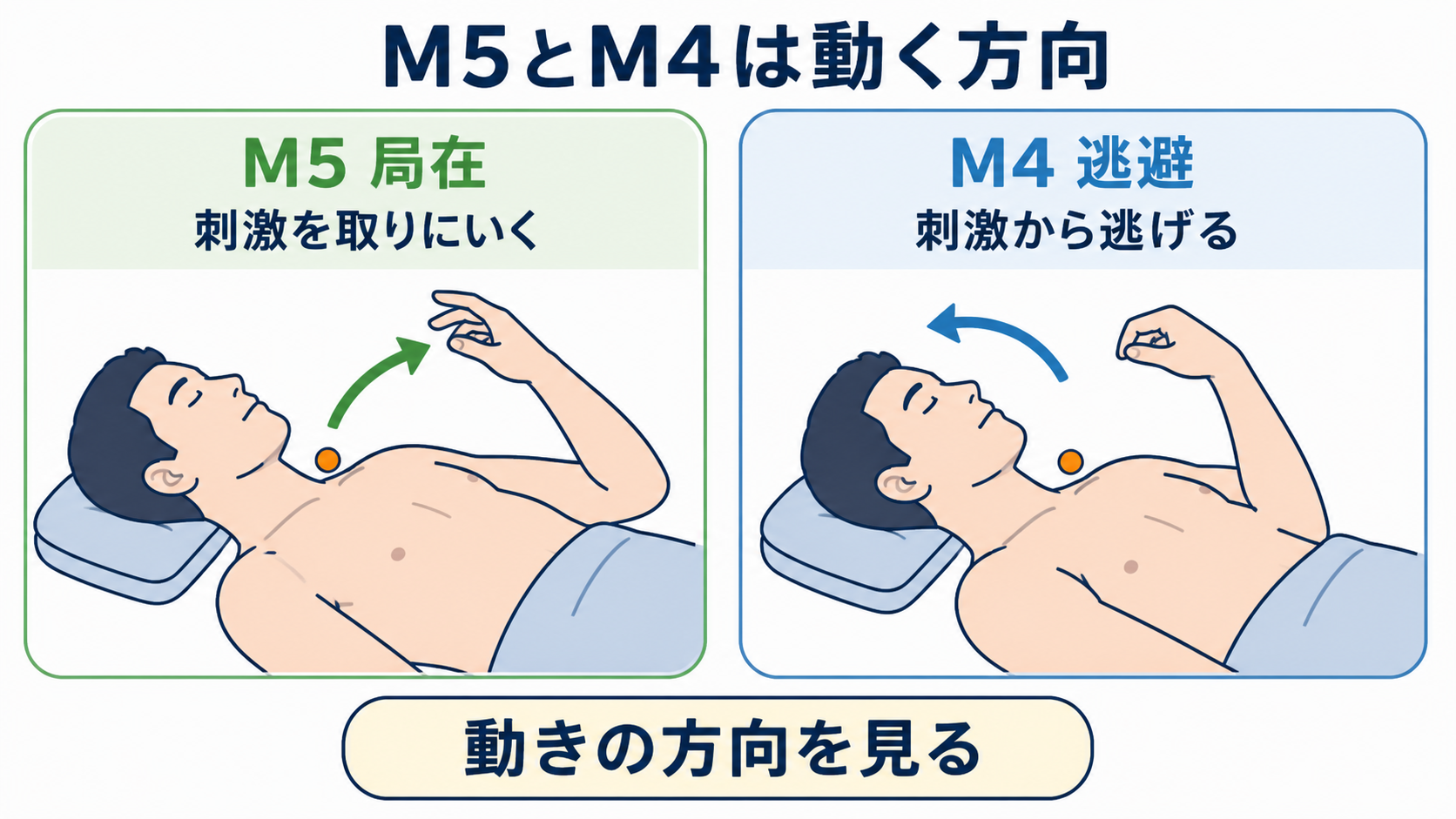 JCSとGCSの違いと評価方法｜意識レベルを正しく観察・記録するポイント：GCSで最も迷いやすいM4とM5は「刺激の場所へ手が向かうか」で考えるの図解