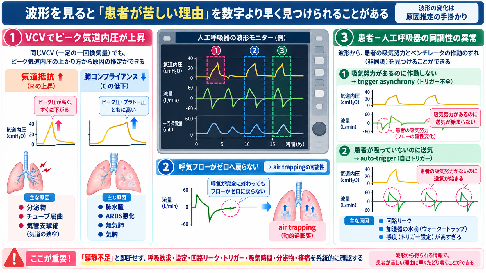 人工呼吸器のモードを理解する｜A/C・SIMV・PSV・CPAPの使い分け、設定、観察項目とアラーム対応：波形を見ると「患者が苦しい理由」を数字より早く見つけられることがあるの図解