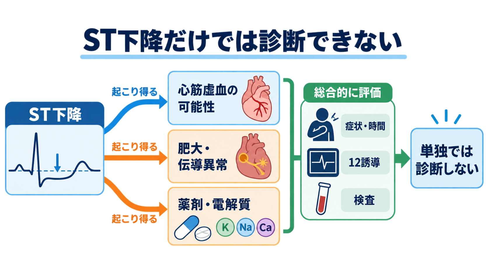 ST下降をどう読む？心筋虚血・心内膜下梗塞と二次性変化、薬剤・電解質異常の見分け方：ST下降は「心筋虚血の可能性」を示すが、原因や梗塞を単独では決められないの図解