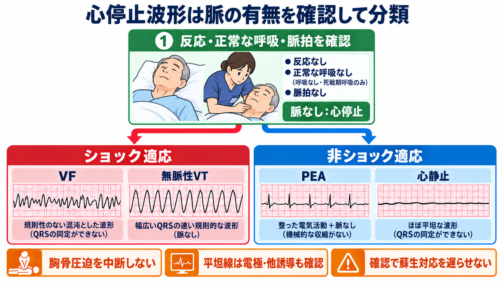 心電図の読み方を基礎から整理｜新人看護師・看護学生のための判読手順と緊急波形：心停止波形はVF・無脈性VTと、PEA・心静止に分けるの図解