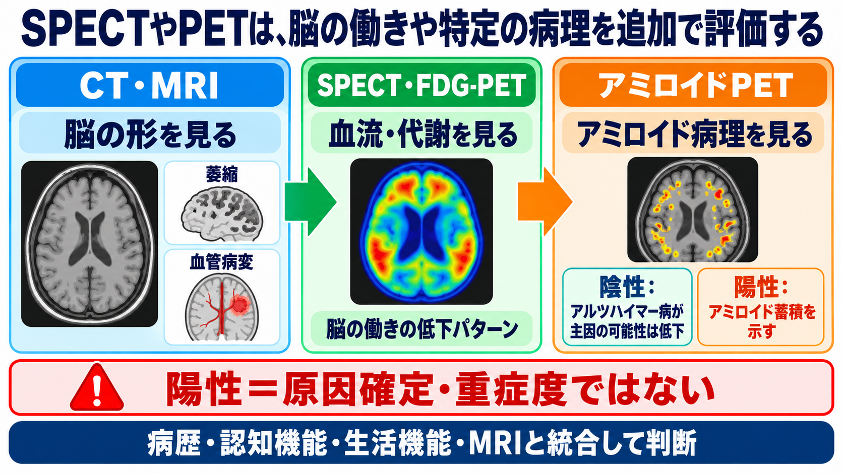 認知症の検査をどう読む？HDS-R・MMSE、画像、血液バイオマーカーをつなぐ見方：SPECTやPETは、脳の働きや特定の病理を追加で評価するの図解