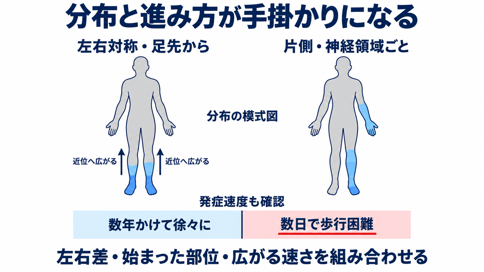 ニューロパチーとは？原因・症状・検査から看護観察と緊急性まで分かりやすく解説：症状の「分布」と「進み方」は原因を絞る重要な手掛かりになるの図解